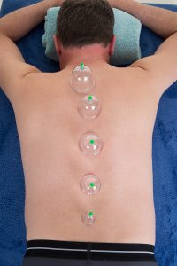 Cupping Therapy Massage