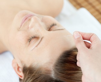 Acupuncture treatment 