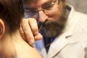 Practitioner practising acupuncture treatment